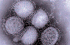 Il virus dell'influenza A al microscopio (Ansa)