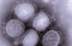 Il virus dell'influenza A al microscopio(Ansa Dba)
